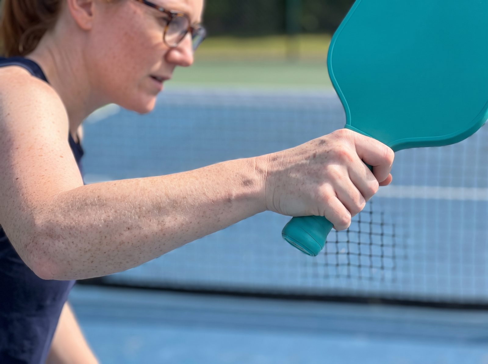 A close view of a freckled forearm and hand squeezing the handle of a teal pickleball paddle hard at the net